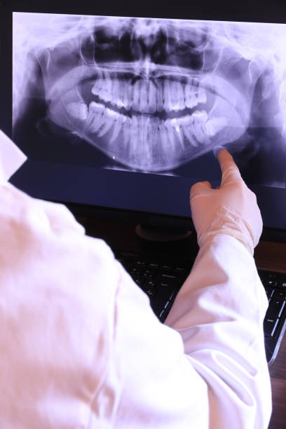 Best Emergency Treatment for Dental Infections or Abscesses in Cross Plains, WI